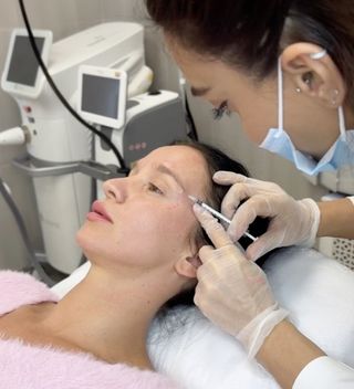 БОТУЛИНОТЕРАПИЯ КОРРЕКЦИЯ МИМИЧЕСКИХ МОРЩИН