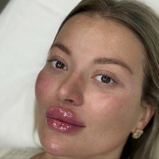После процедуры