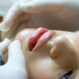 Инъекционная косметология в клинике Zaffiro Clinic