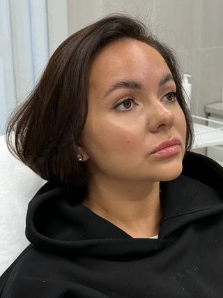 После процедуры