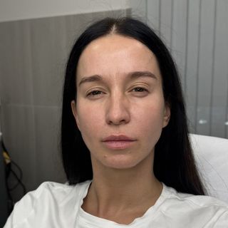 После процедуры