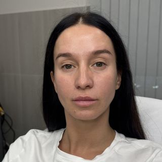 После процедуры